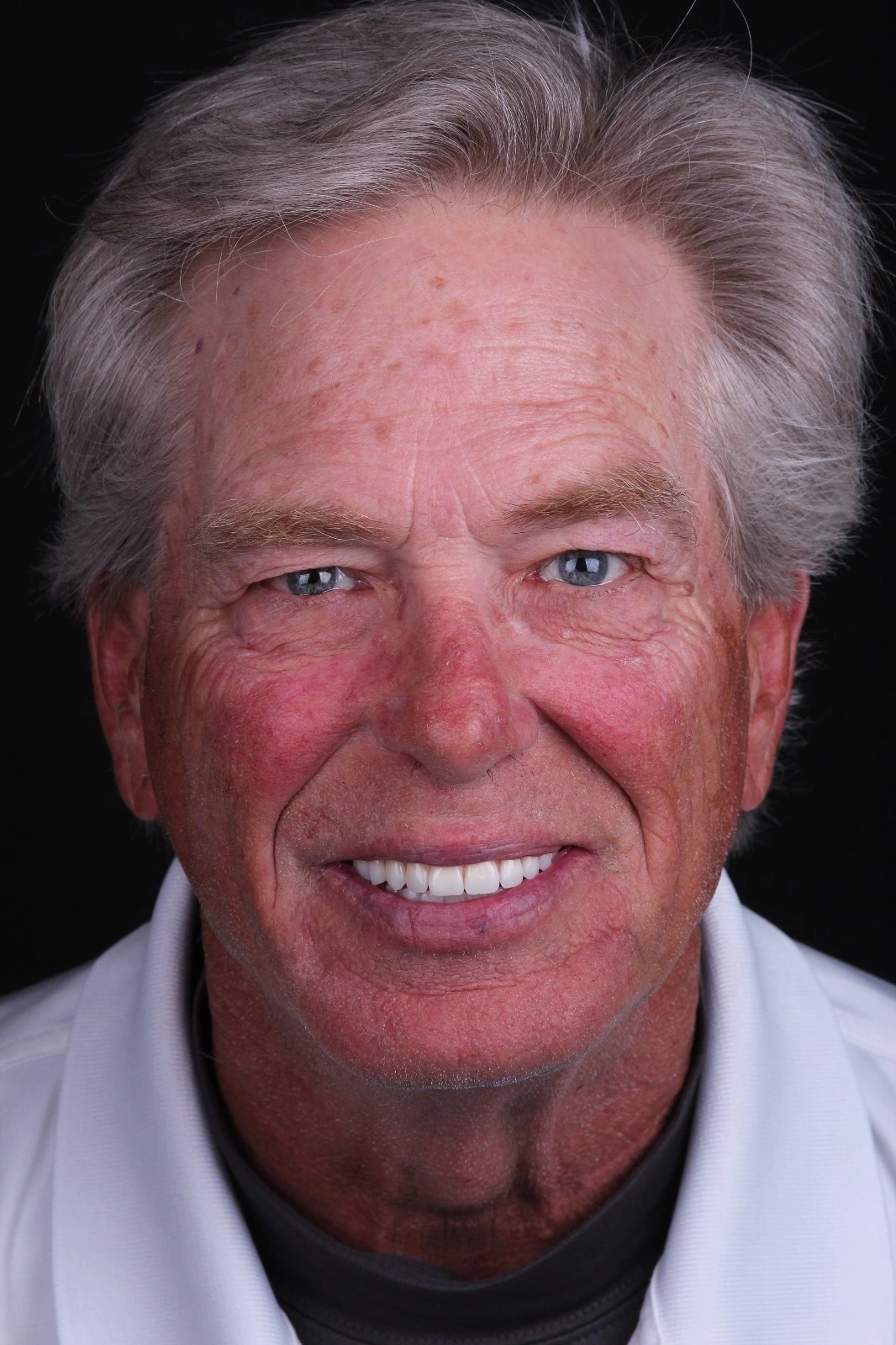 All-on-4® Dental Implants