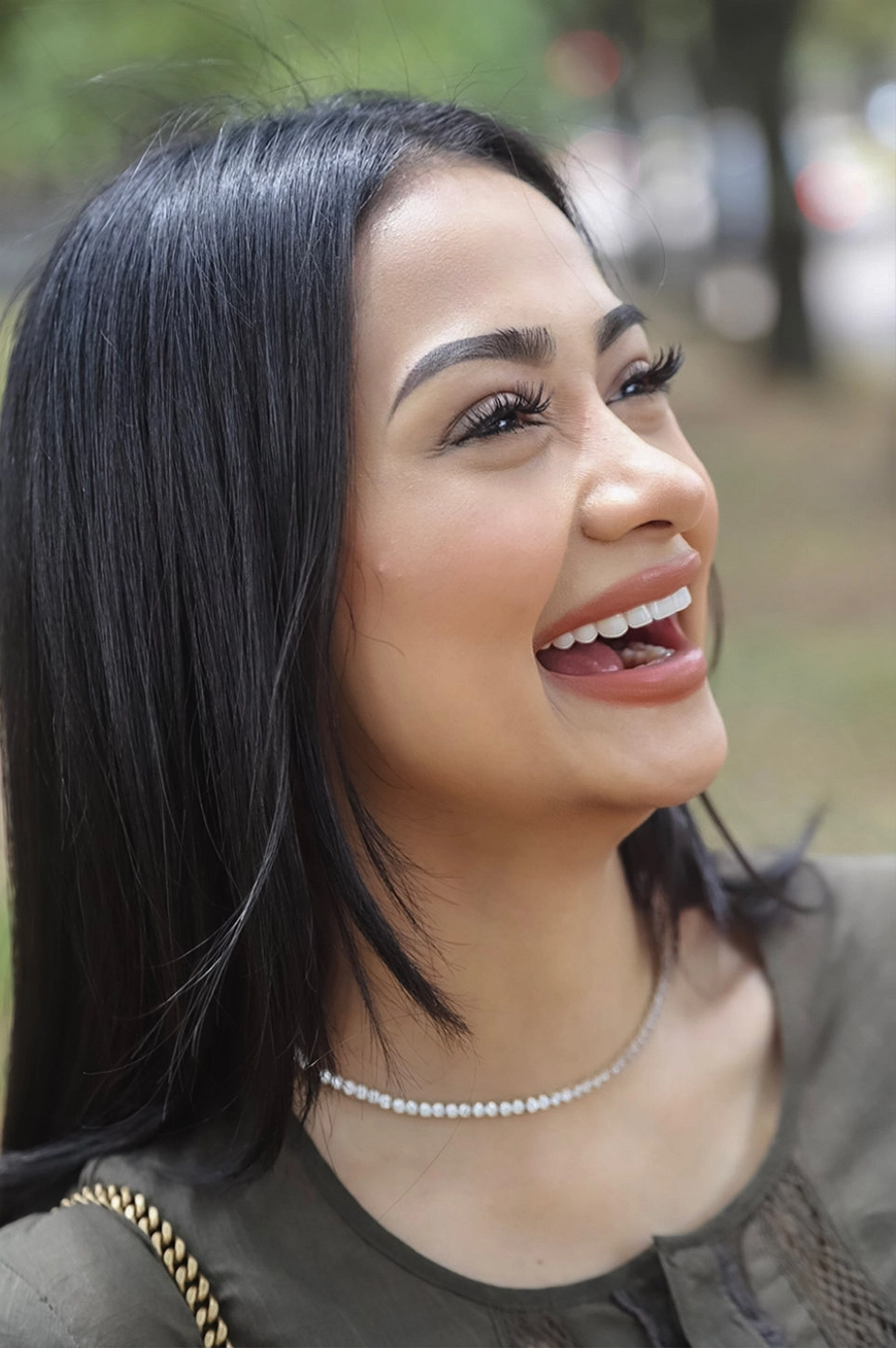 Veneers in Sugar Land