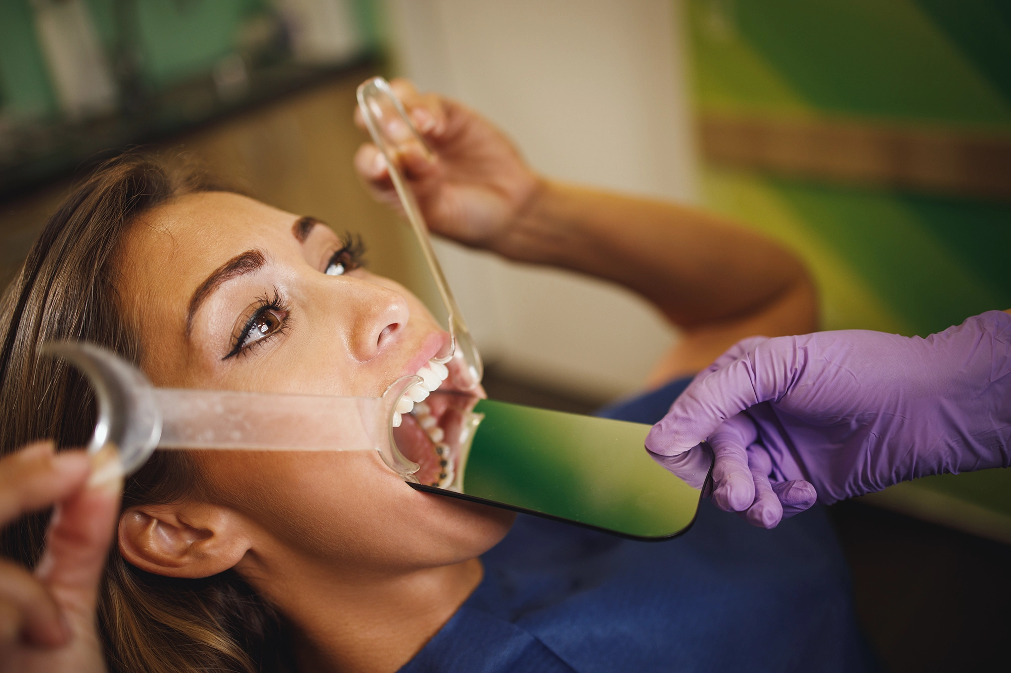 Bone Grafting Sugar Land